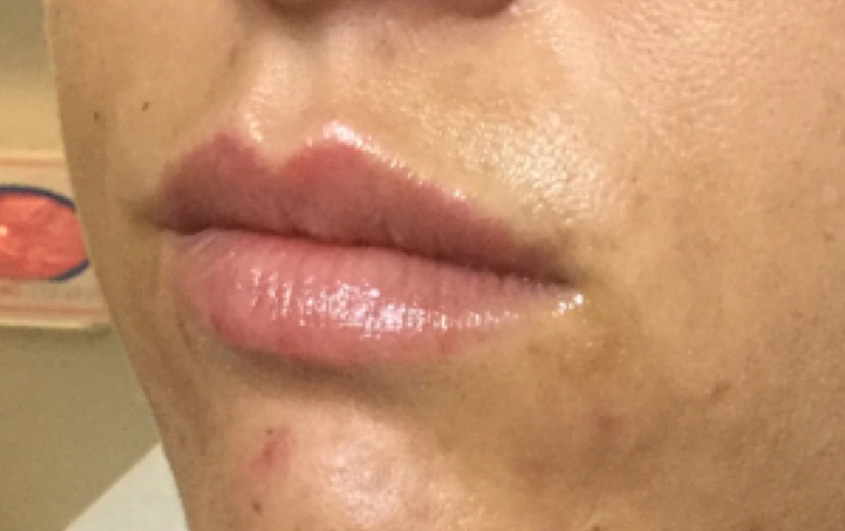 After