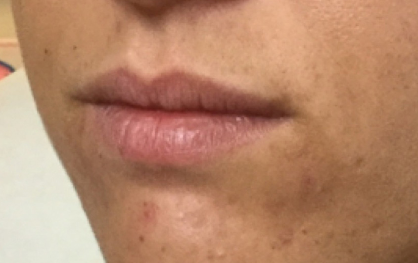 Before